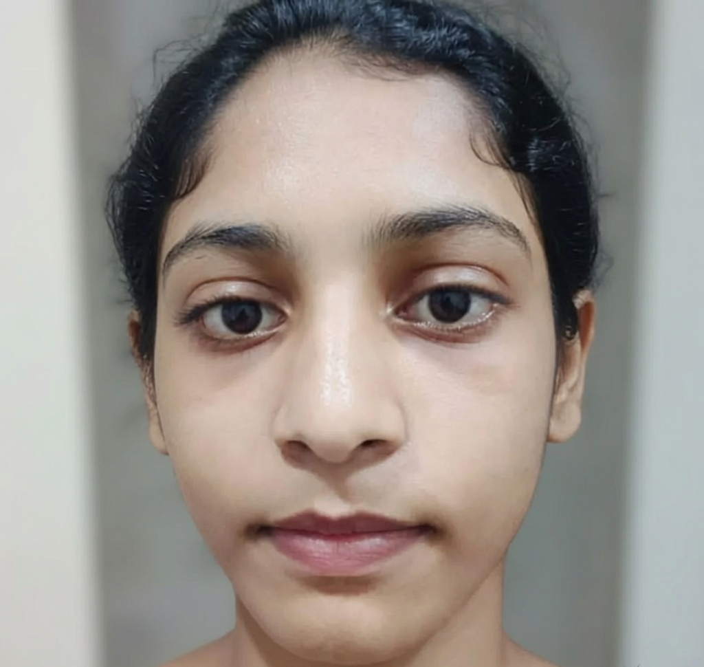 After image